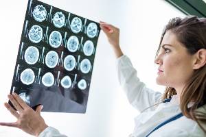 doctor analyzing brain mris