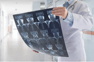 nerve damage due to crash