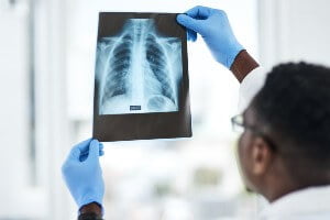 doctor looking at ribcage x-rays
